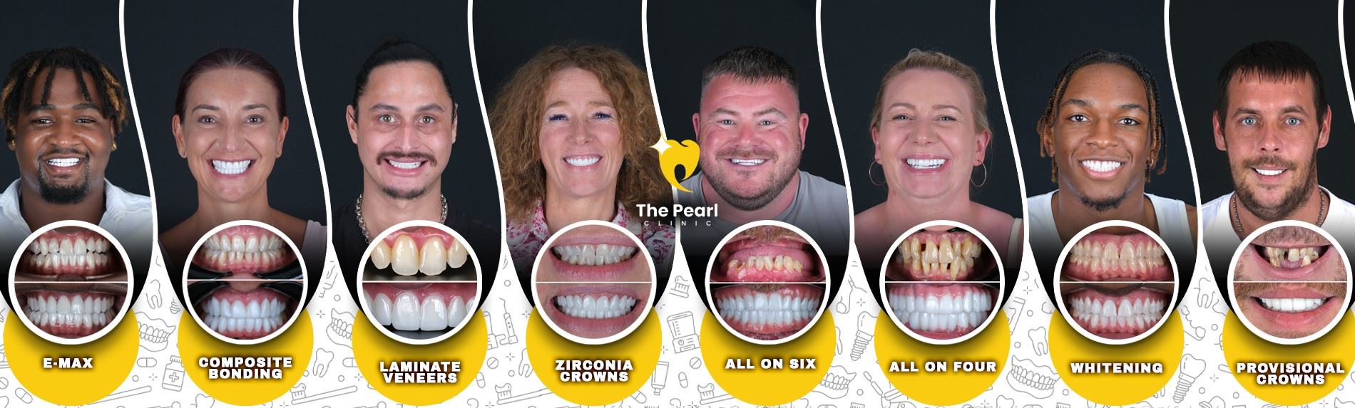 Tooth Coating Methods