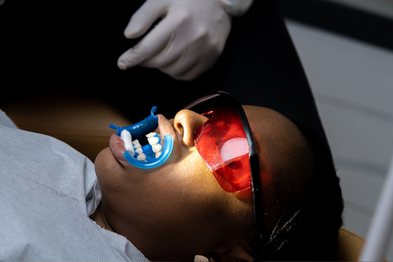 LED light activation during Zoom teeth whitening