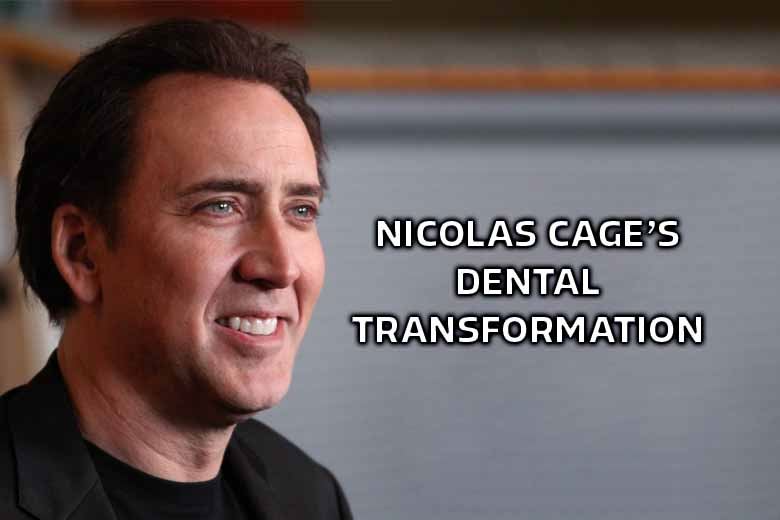 Nicolas Cage’s Secret Smile Makeover