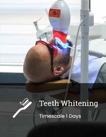 Diş Beyazlatma
