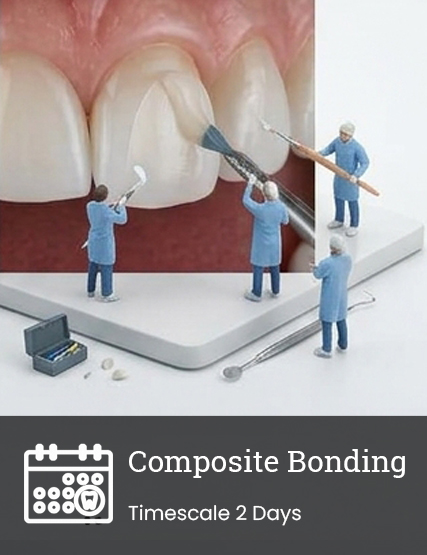 Composite Bonding  (Veneers)