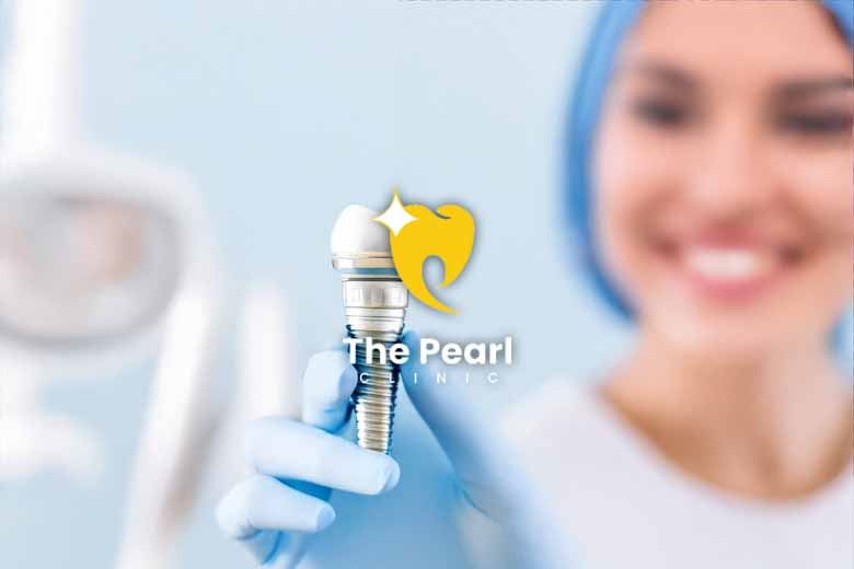 Things to Keep in Mind After Getting Implants!