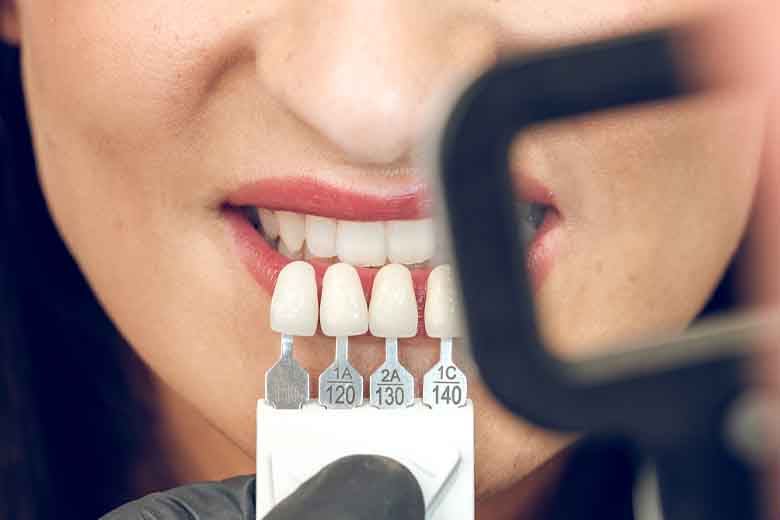 Tooth Coating Methods