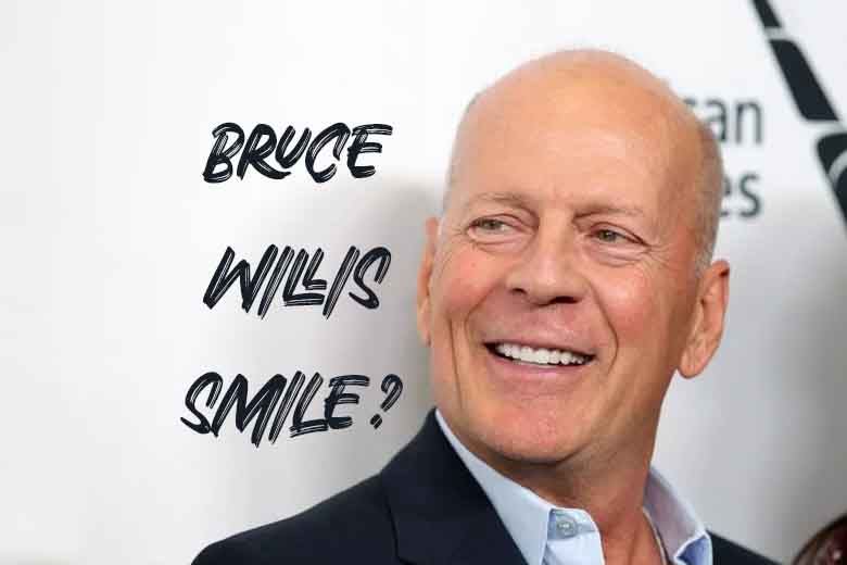 Bruce Willis Smile? Discover Male Smile Trends in Antalya