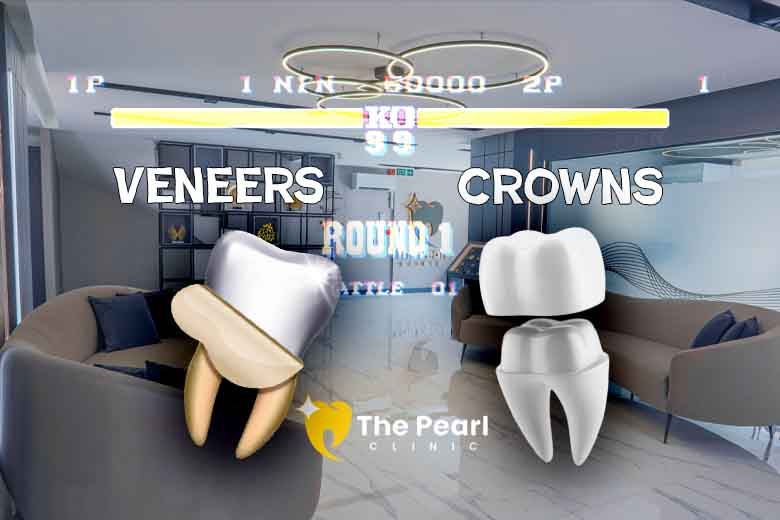 Antalya Smile Makeover: Crowns vs Veneers Explained