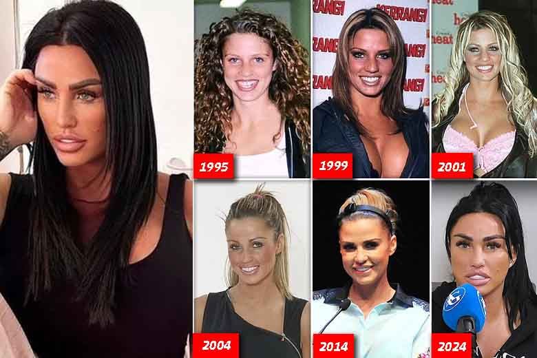Katie Price’s Dental Journey: