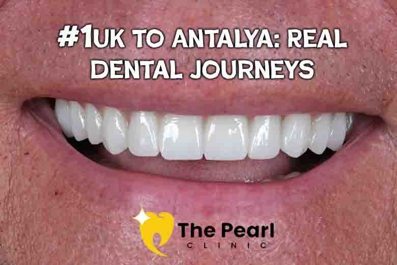 UK Patients Are Flocking to Turkey for New Smiles – Here’s Why