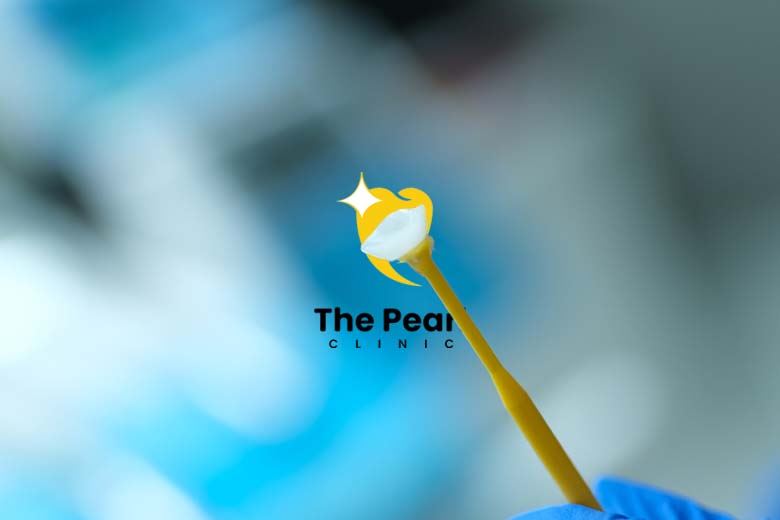 Laminate Veneers: All You Need to Know!