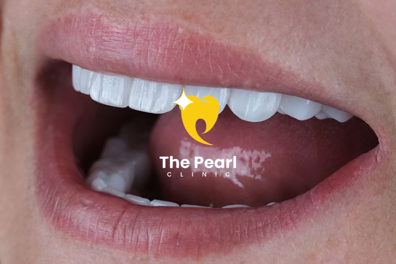 Unlock the Secrets Behind Smile Design!